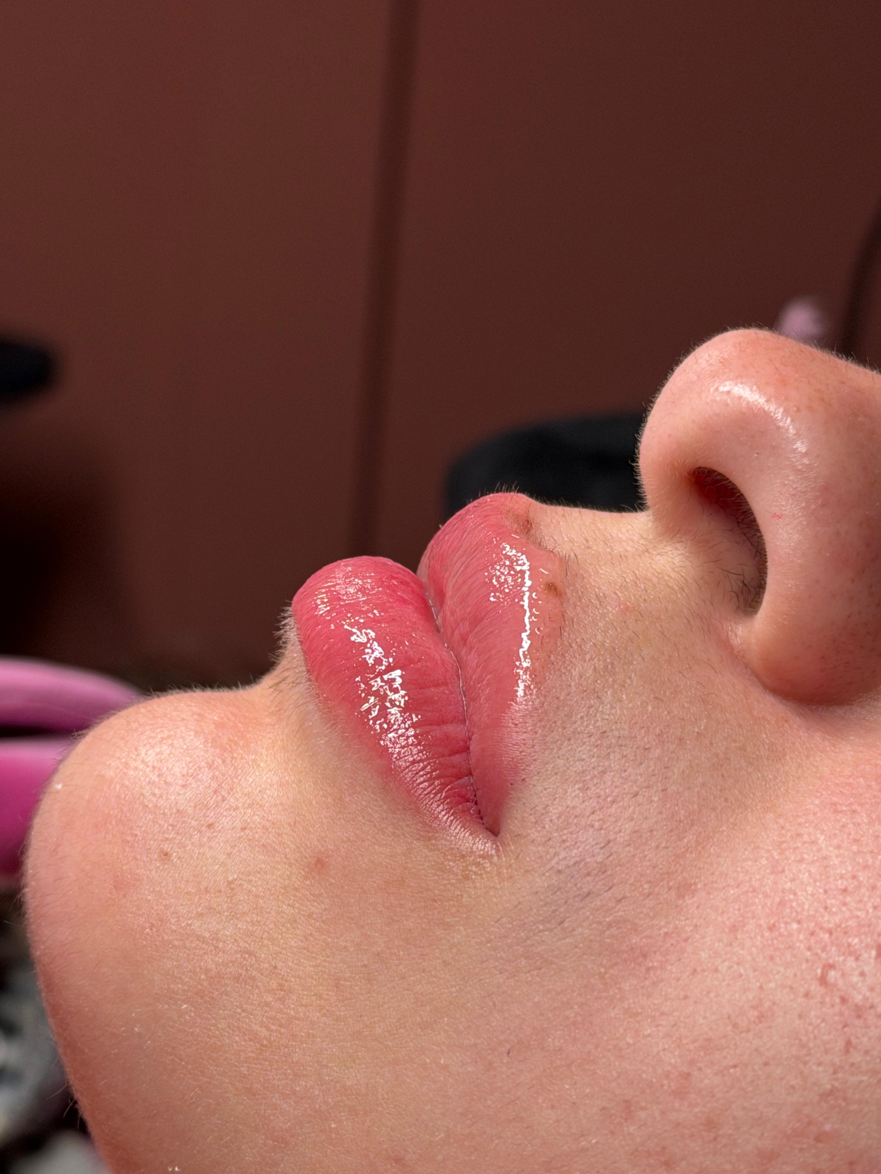 Glow Face Beauty result